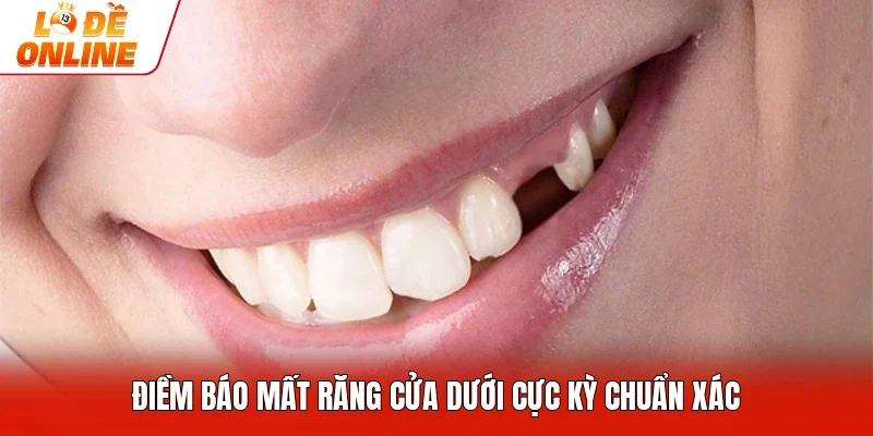 Điềm báo mất răng cửa dưới cực kỳ chuẩn xác