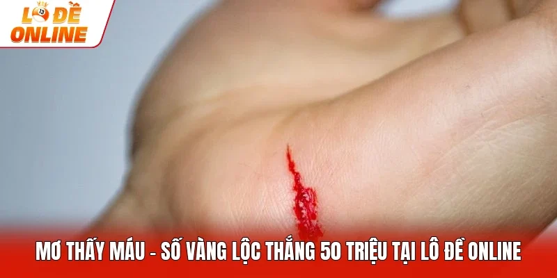 Mơ Thấy Máu - Số Vàng Lộc Thắng 50 Triệu Tại Lô Đề Online